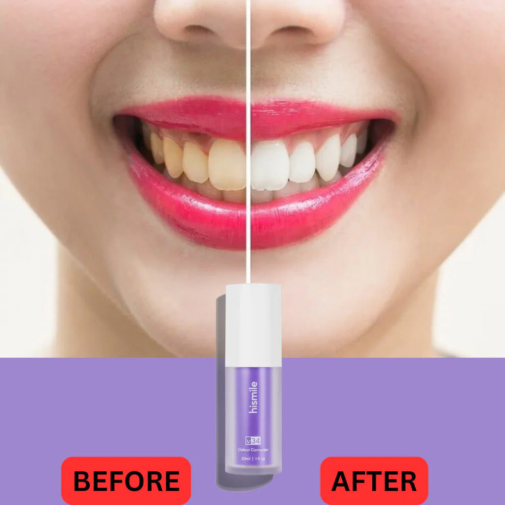 Hismile V34 Colour Corrector | Teeth Whitening Serum